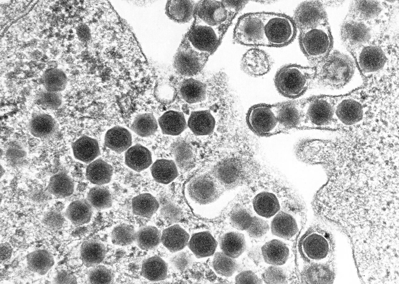 Micrograph slide of ranaviruses gathering close to the cell border where they can be seen leaving the cell via a process called budding.
