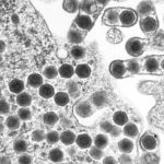 A microscopic image of ranavirus.